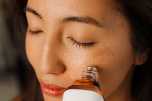 Microneedling in Lahore